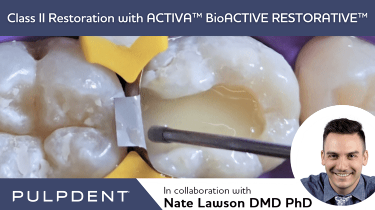 Lire la suite de l'article Restauration de classe II avec ACTIVA™ BioACTIVE-RESTORATIVE™