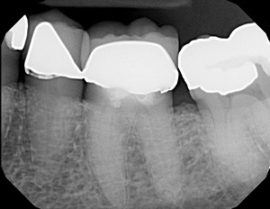 Lire la suite de l'article Dentaltown publie un rappel de 70 ans