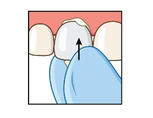 Lire la suite de l'article Couronnes Strips en 5 étapes faciles