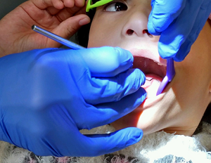 Lire la suite de l'article PULPDENT soutient les enfants qui ont besoin de soins dentaires