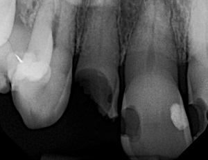 Lire la suite de l'article Dentisterie héroïque : Sauver la vie de Judy