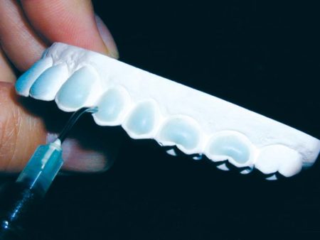 clinical-procedure-kool-dam-3