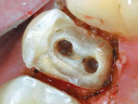 clinical-procedure-spee-dee-1