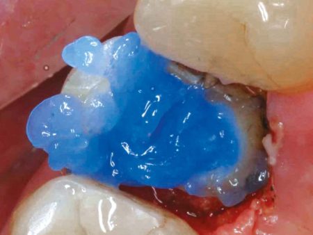 clinical-procedure-spee-dee-2
