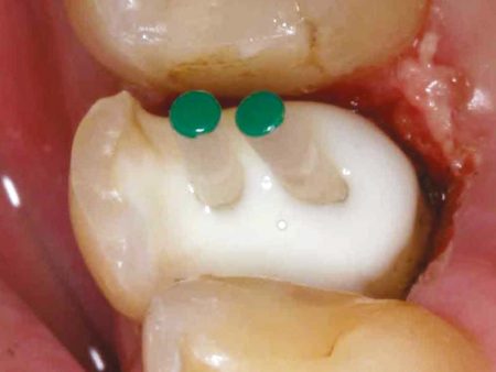 clinical-procedure-spee-dee-4