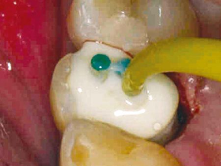 clinical-procedure-spee-dee-5