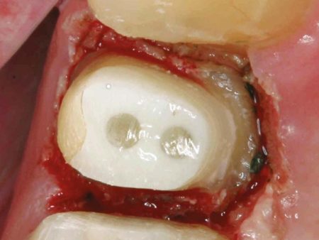 clinical-procedure-spee-dee-6