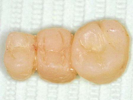 clinical-procedure1-seal-n-shine-1