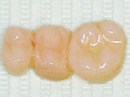 clinical-procedure1-seal-n-shine-2