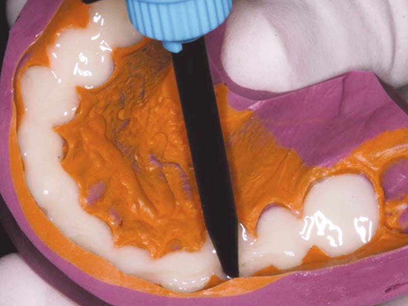 clinical-procedure1-tuff-temp-plus-1