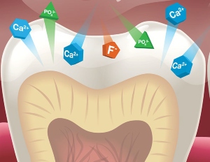 Lire la suite de l'article Quatre mythes sur le vernis fluoré