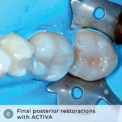 La dentisterie héroïque : Restaurations ACTIVA rapides, efficaces, en une seule visite et en plusieurs unités