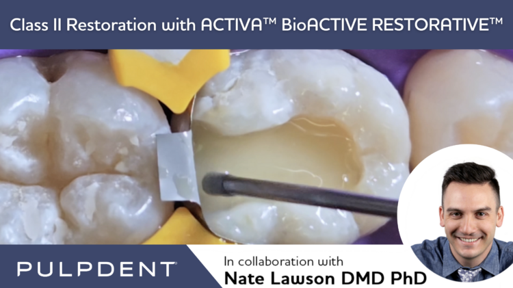 Lire la suite de l'article Restauration de classe II avec ACTIVA™ BioACTIVE-RESTORATIVE™