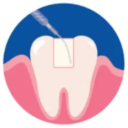 bulk-fill-img-1 bulk-fill-img-1